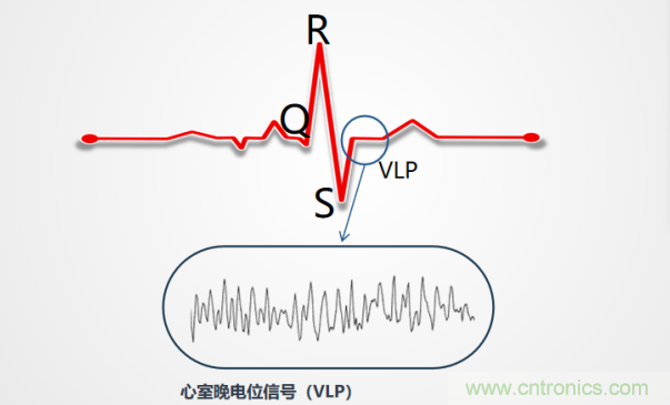 解決心電監(jiān)測(cè)行業(yè)難題，曼森伯格的濾波技術(shù)獲國(guó)家知識(shí)產(chǎn)權(quán)局發(fā)明授權(quán)